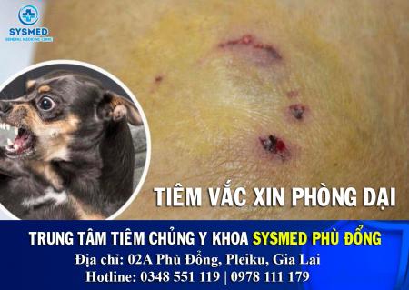 Khi nào cần tiêm Vắc xin Phòng Dại? - Sysmed Phù Đổng