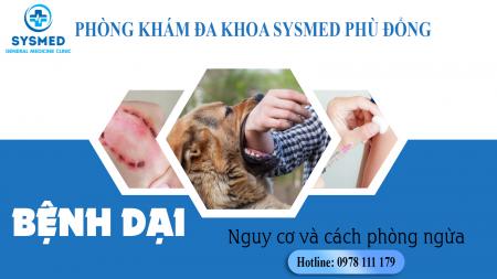 Bị Chó Cắn Sau 10 Ngày: Nguy Cơ Tiềm Ẩn Và Giải Pháp Phòng Ngừa Hiệu Quả